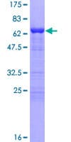 Human TMOD4 Protein (Recombinant GST)