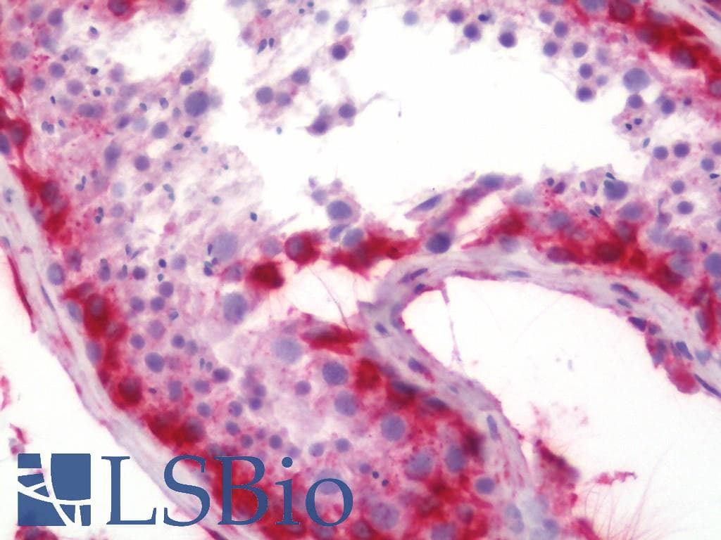 IHC-plus™ MRPL34 Antibody (aa21-70)