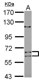 Polyclonal Rabbit anti-Human ADAD1 Antibody (WB)