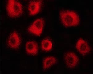 VCL / Vinculin Antibody (phospho-Tyr821)