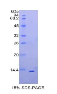 Mouse OSM / Oncostatin M Protein (Recombinant His)