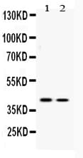 ATF4 Antibody