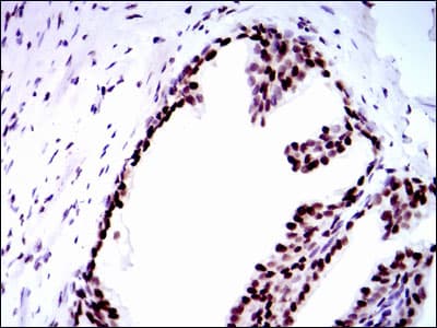 RPA70 / RPA1 Antibody (clone 4C4)