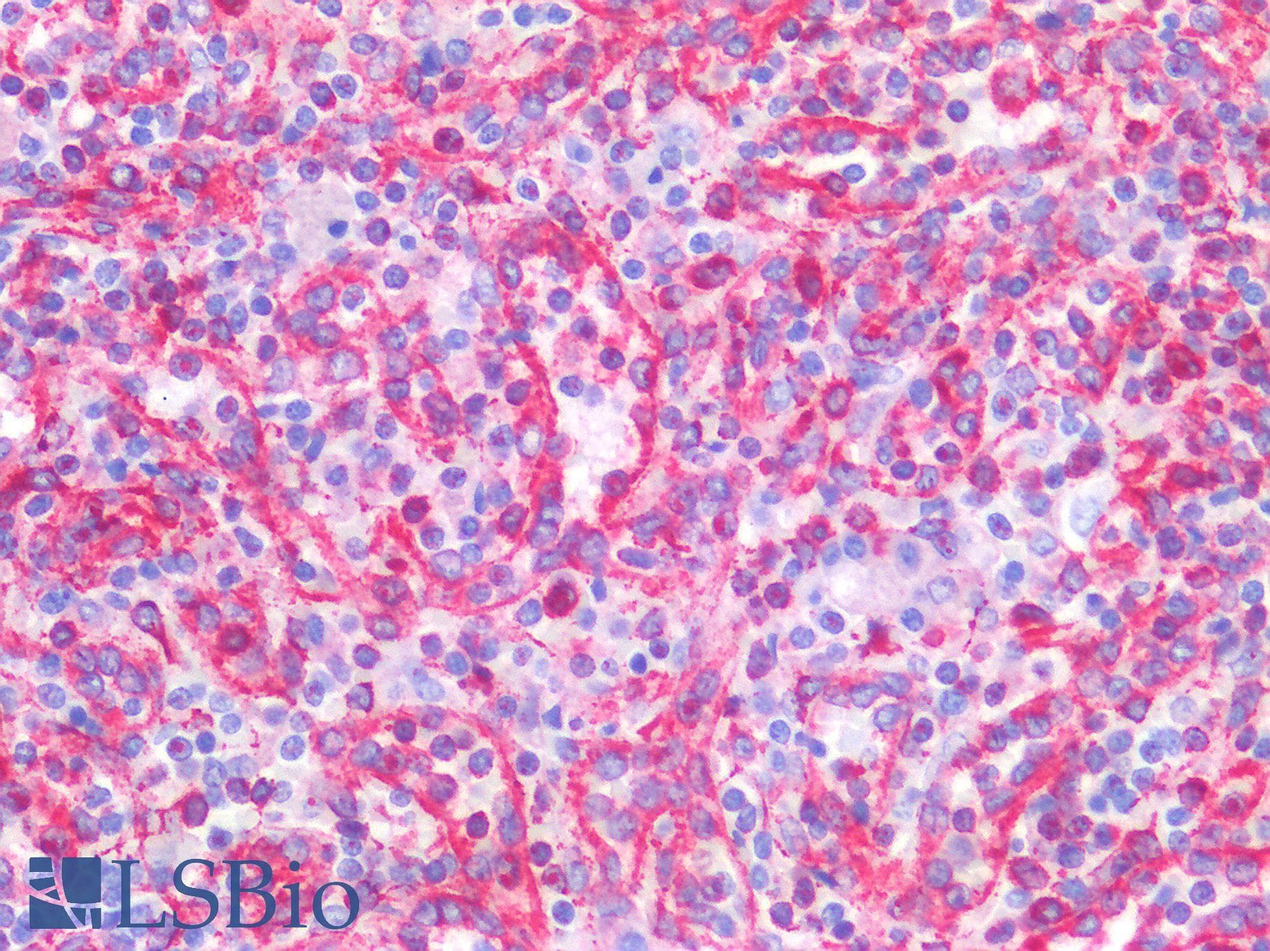 IHC-plus™ TMEM173 / STING Antibody