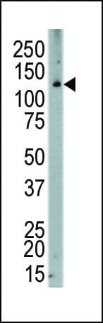 CSF1R / CD115 / FMS Antibody (aa940-971)