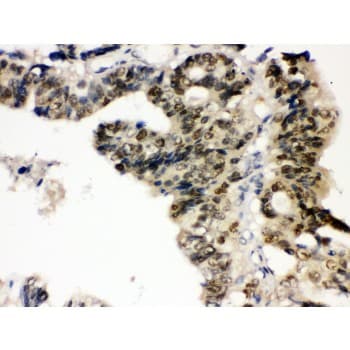 PTPN2 / TC-PTP Antibody (aa1-330)