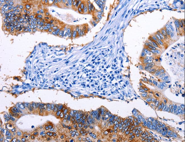 Polyclonal Rabbit anti-Human EPCAM Antibody (IHC)