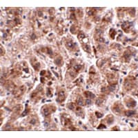 TREX2 Antibody