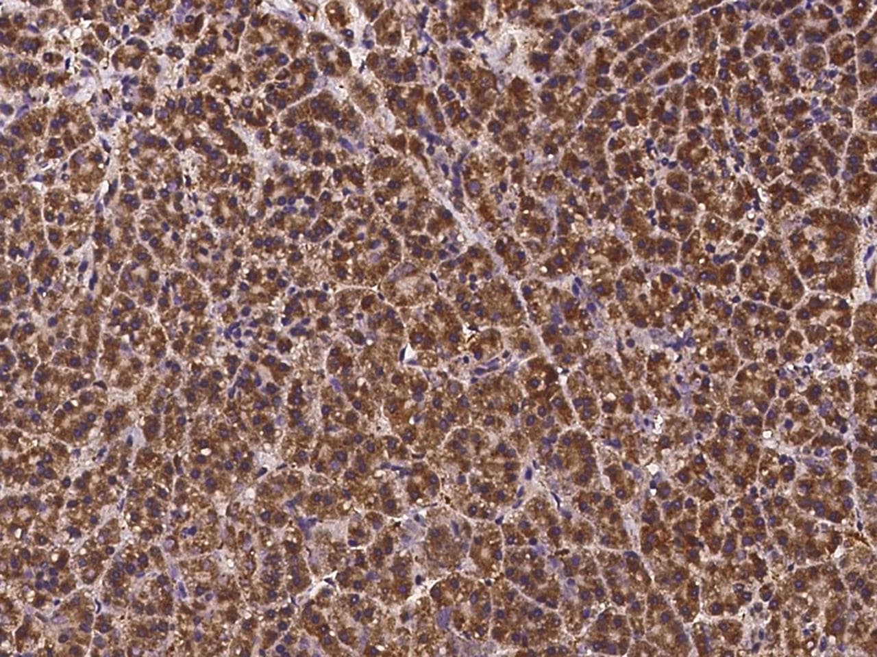 Polyclonal Rabbit anti-Human DCUN1D2 Antibody (IHC)