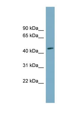 Polyclonal Rabbit anti-Human FAM53C Antibody (aa35-84, WB)