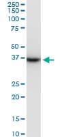 PRSS8 / Prostasin Antibody (clone 3C4)