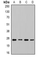 Polyclonal Rabbit anti-Human CHMP1B Antibody (IHC, WB)