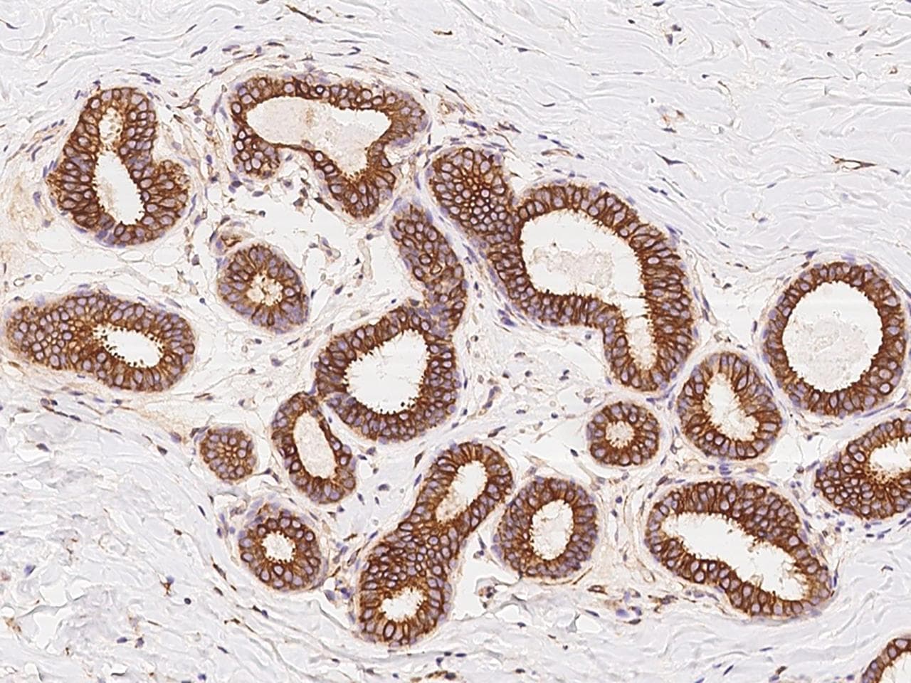 PPP3CB Antibody