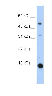 CCL2 / MCP1 Antibody (C-Terminus)
