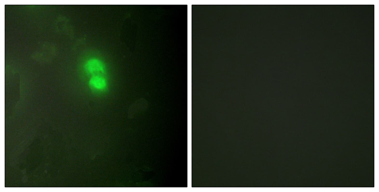 Polyclonal Rabbit anti-Human DKC1 / Dyskerin Antibody (aa171-220, IF, WB)