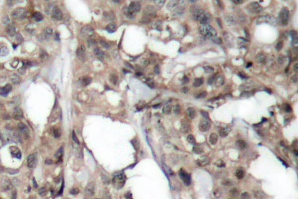 Polyclonal Rabbit anti-Human AKT1 + AKT2 + AKT3 Antibody (Asp302, IHC, WB)