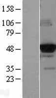 GCK / Glucokinase Protein (Over-Expression Lysate Myc-DDK (Flag))