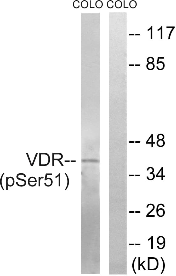 Vitamin D Receptor / VDR Antibody (phospho-Ser51)