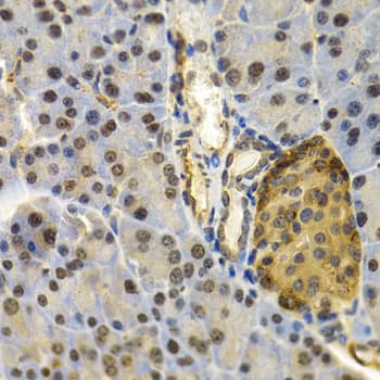 FAT10 / UBD Antibody