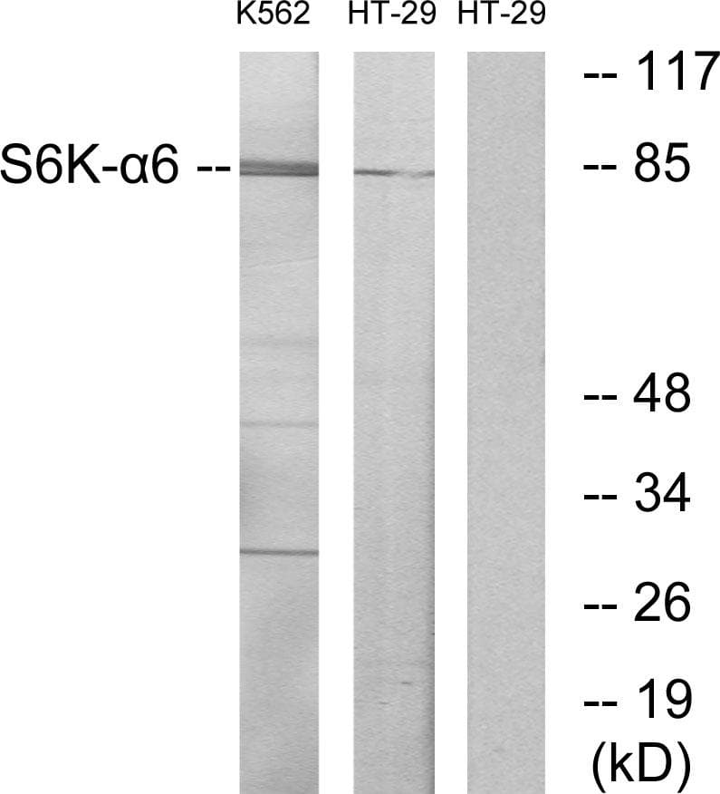 RPS6KA6 / RSK4 Antibody