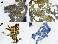 IHC-plus™ Monoclonal Mouse anti-Human S100A7 / Psoriasin Antibody (clone 47C1068, IHC, WB)