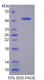 Human CCBL1 Protein (Recombinant His)