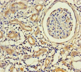 KRT71 / Keratin 71 Antibody