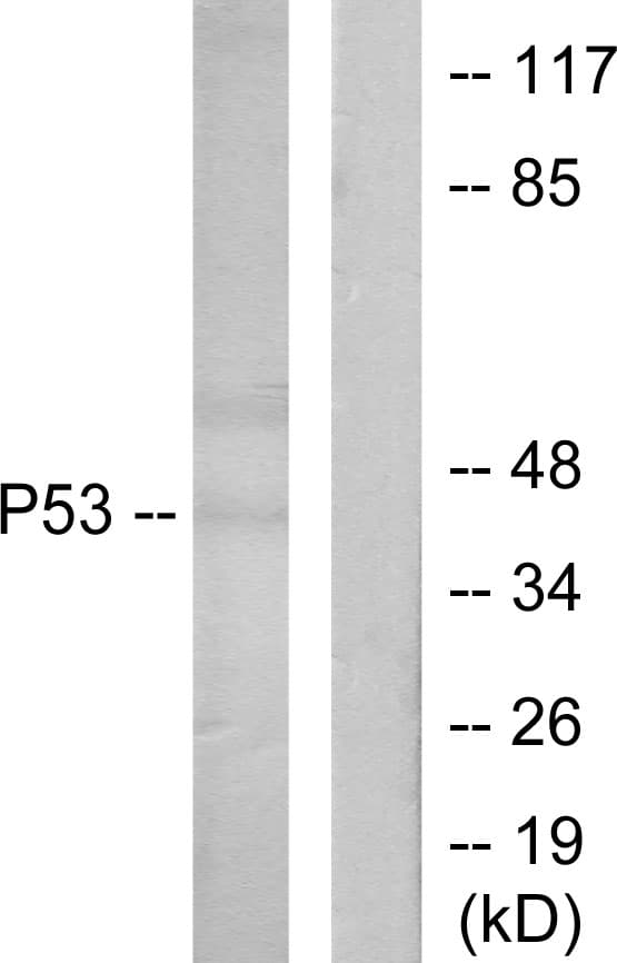 TP53 / p53 Antibody (aa15-64)