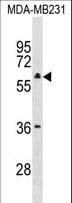 TBC1D10A Antibody (aa239-267)