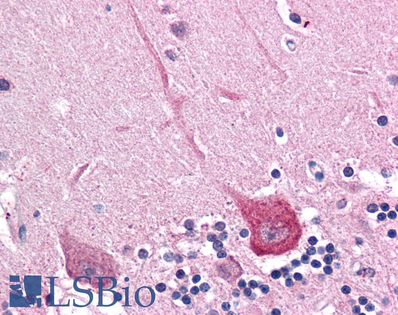 IHC-plus™ DLGAP2 Antibody