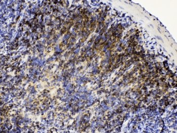 LYN Antibody