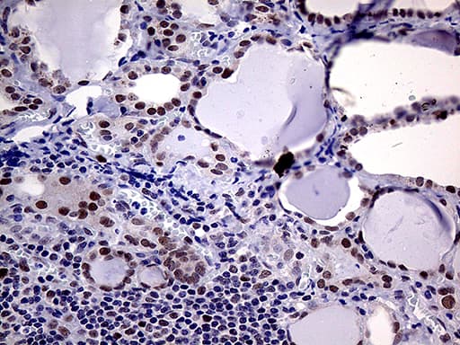 MLH1 Antibody (aa299-527, clone OTI3C1)