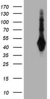 SH2D2A Antibody (clone OTI3C7)