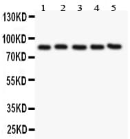Polyclonal Rabbit anti-Human PECAM-1 / CD31 Antibody (aa28-382, IHC, WB)