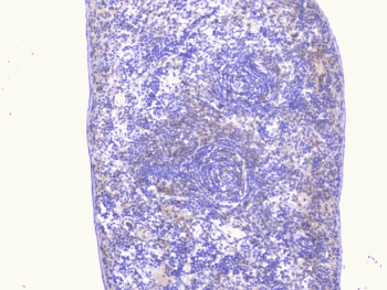 PCDH15 Antibody