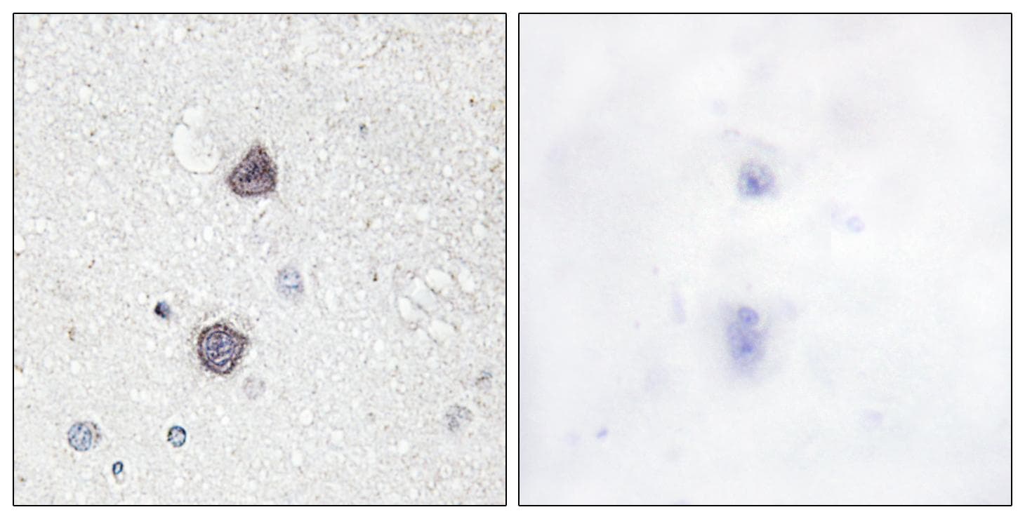 AQP2 / Aquaporin 2 Antibody (phospho-Ser256)