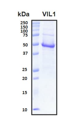 Human VIL1 / Villin Protein (Recombinant His, N-Terminal)
