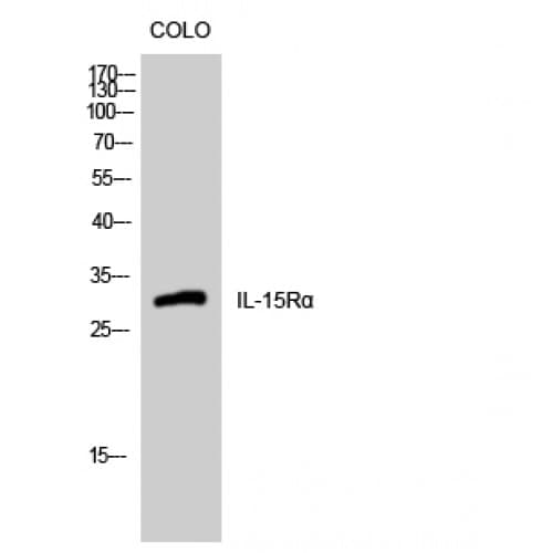 IL15RA Antibody (70-150 aa, Internal)