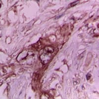 Polyclonal Rabbit anti-Human COL2A1 / Collagen II Alpha 1 Antibody (N-Terminus, IHC, WB)