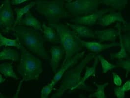 IHC-plus™ Basigin / Emmprin / CD147 Antibody (clone 10E10)
