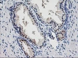 PNMT Antibody (clone OTI2F2)