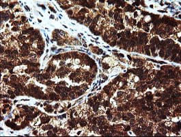 Monoclonal Mouse anti-Human Mannose Phosphate Isomerase Antibody (clone OTI1C7, Carrier-free, IHC, IF, WB)