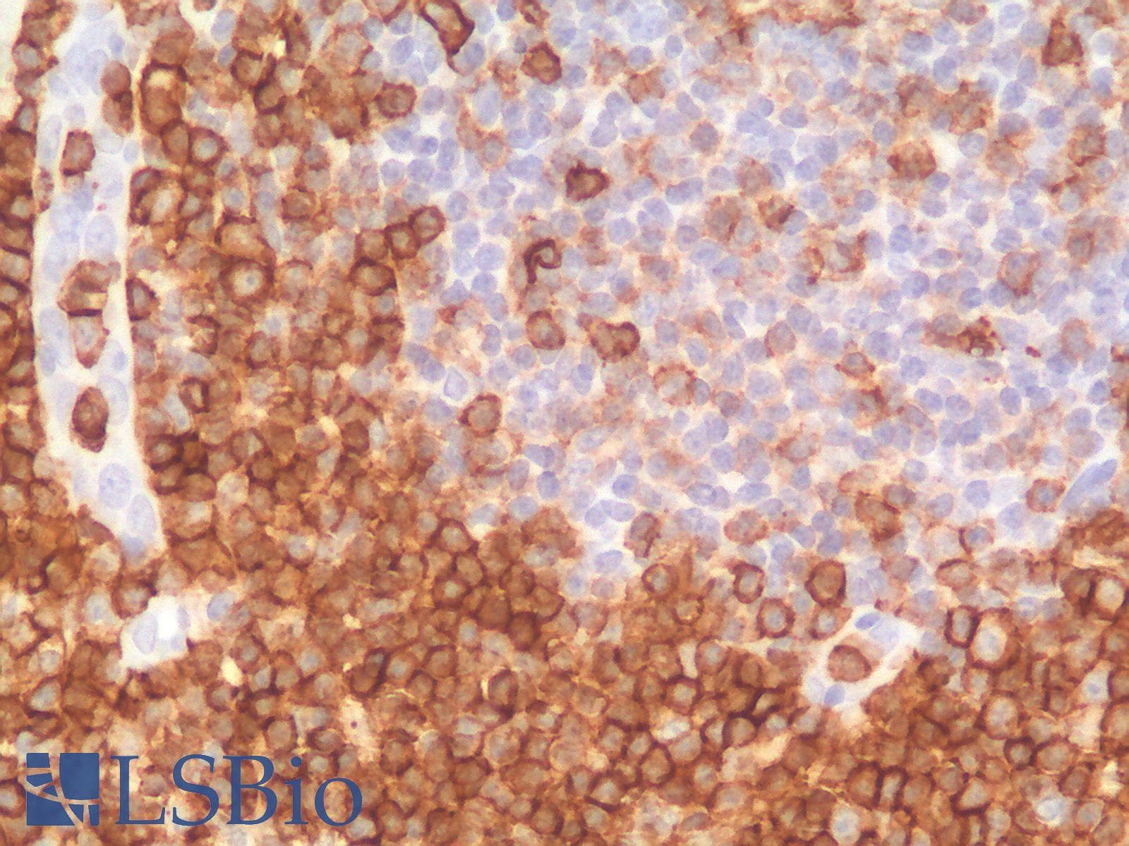 PathPlus™ SPN / CD43 Antibody (clone SPN/1766R)