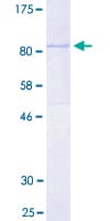 Human PLAT / TPA Protein (Recombinant GST)