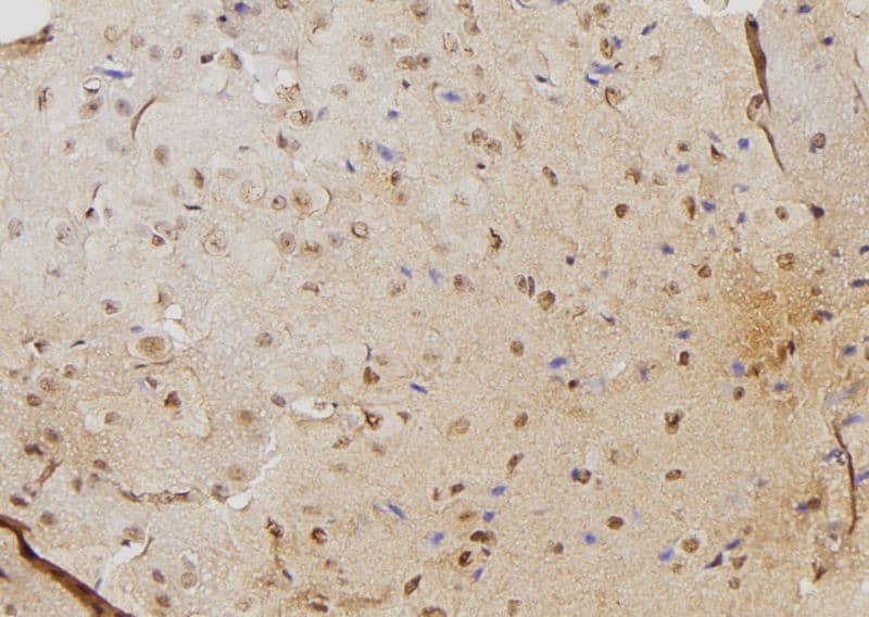 PSME3 Antibody