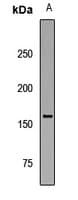 Polyclonal Rabbit anti-Human HFM1 Antibody (WB)