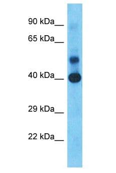 Polyclonal Rabbit anti-Human ADH4 Antibody (aa122-171, WB)