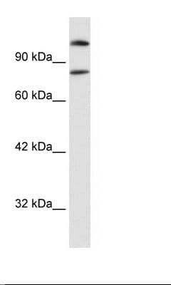 SREBF2 / SREBP2 Antibody (aa434-483)