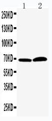 PADI4 / PAD4 Antibody (aa492-512)