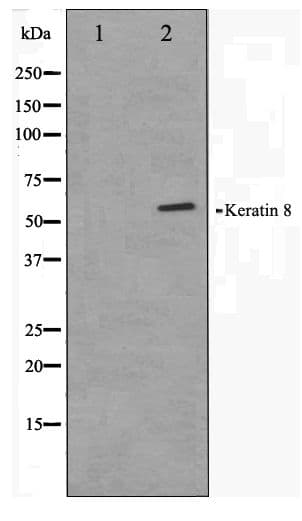 Polyclonal Rabbit anti-Human KRT8 / CK8 / Cytokeratin 8 Antibody (IHC, WB)
